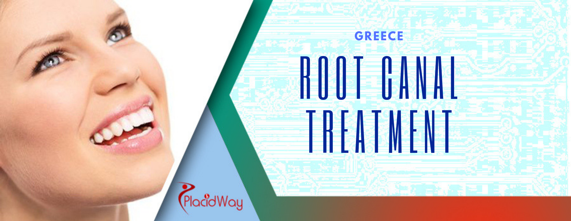 Root Canal in Greece
